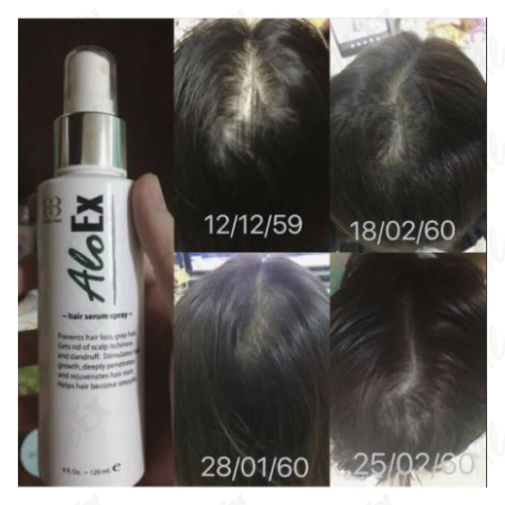 ก่อนใช้-หลังใช้ ผลิตภัณฑ์ AloEx