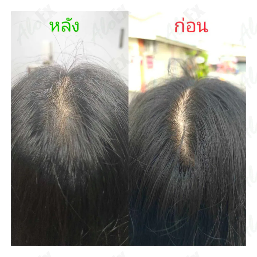 ก่อนใช้-หลังใช้ ผลิตภัณฑ์ AloEx