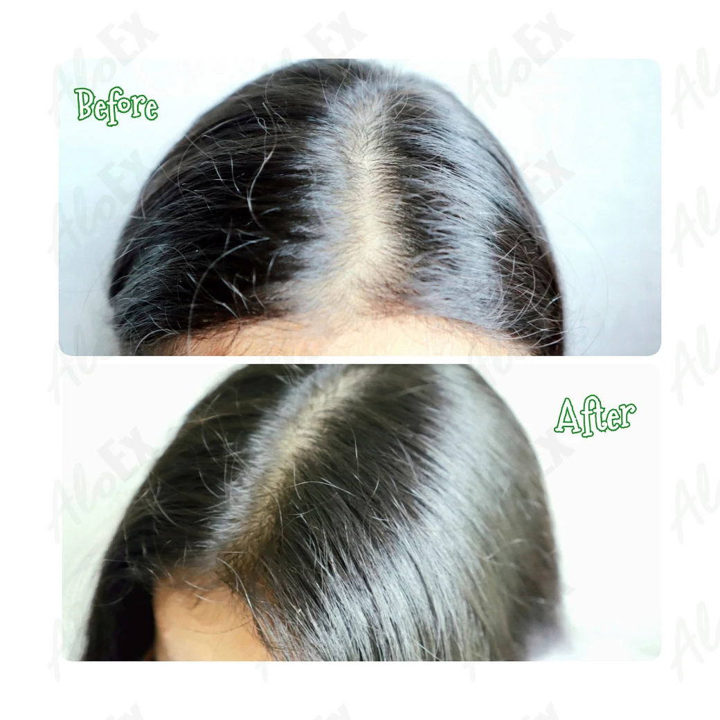 ก่อนใช้-หลังใช้ ผลิตภัณฑ์ AloEx