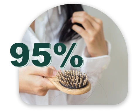 95% ของอาการผมร่วงเกิดจาก Androgenetic Alopecia