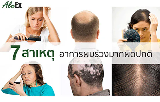ผมร่วงนี้มีที่มา : 7 สาเหตุอาการผมร่วงมากผิดปกติ