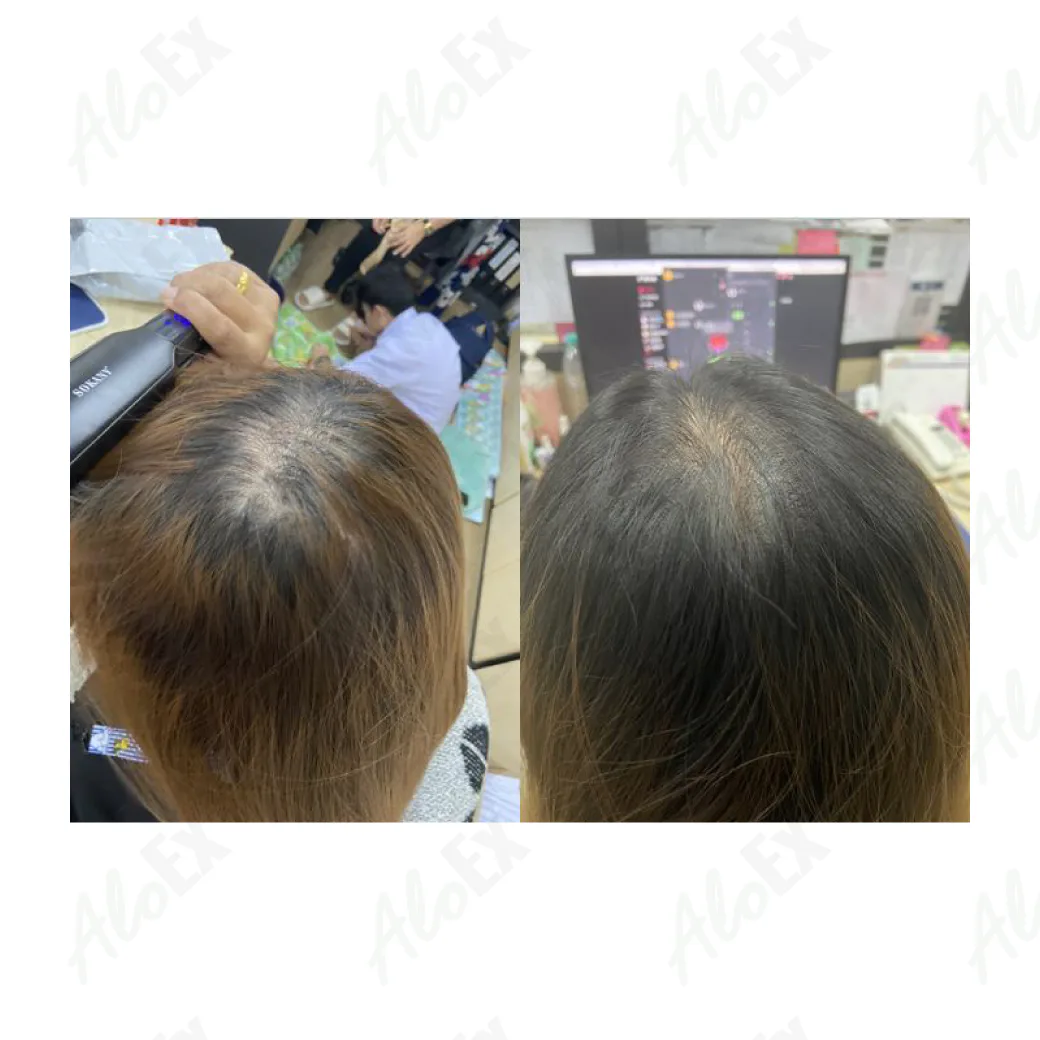 ก่อนใช้-หลังใช้ ผลิตภัณฑ์ AloEx