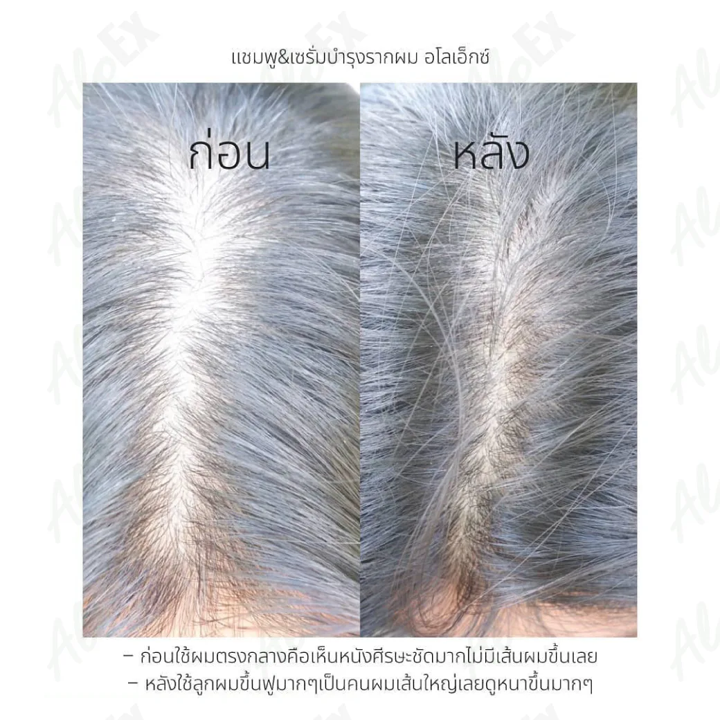 ก่อนใช้-หลังใช้ ผลิตภัณฑ์ AloEx