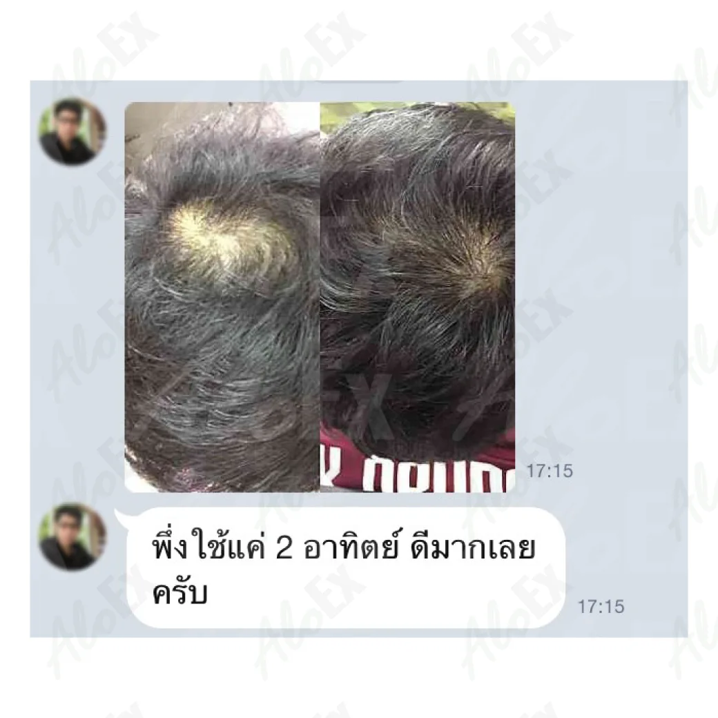 ก่อนใช้-หลังใช้ ผลิตภัณฑ์ AloEx