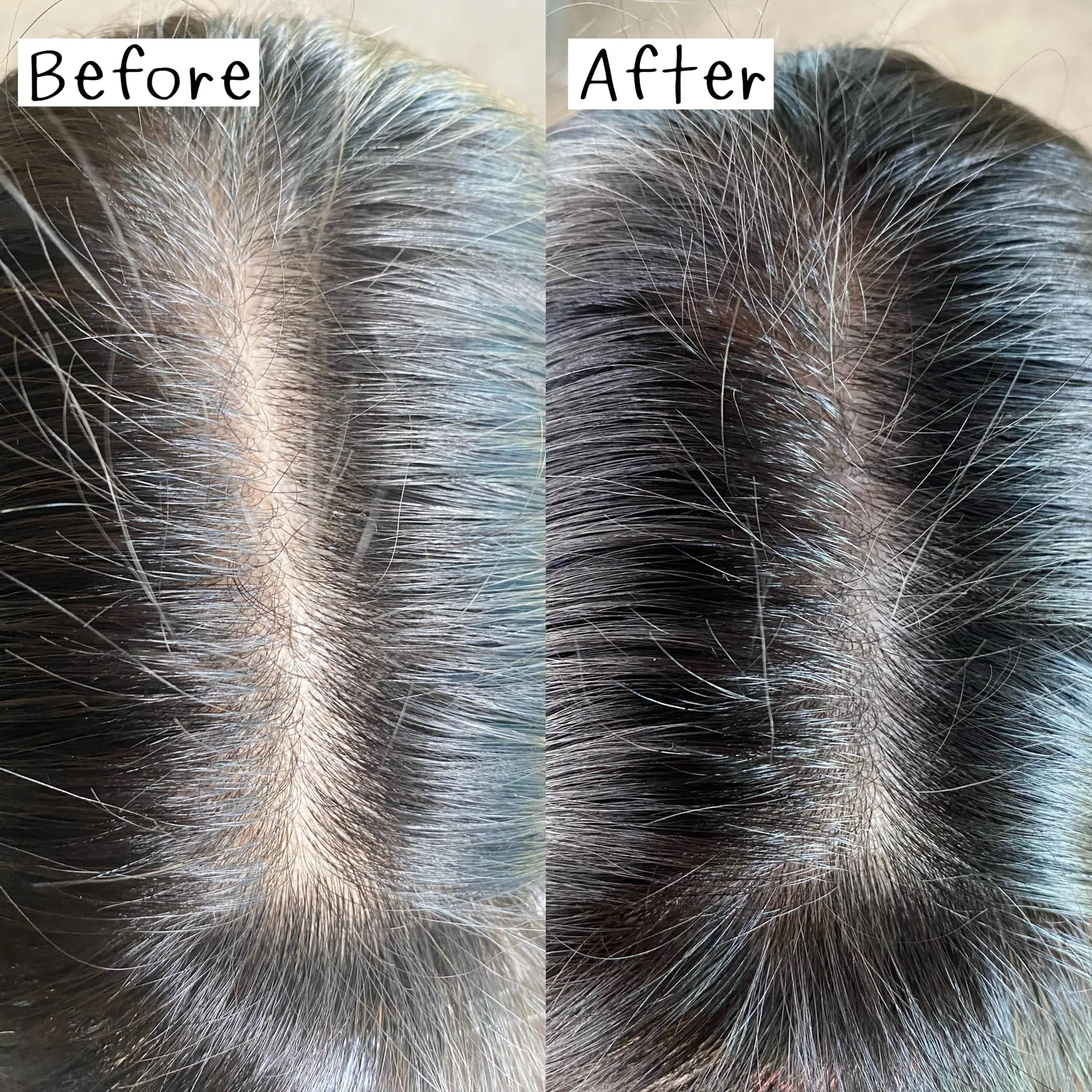 ไม่แน่ใจว่าผมที่พื้นกับบนหัวตรงไหนเยอะกว่ากัน? จึงอยากมาบอกต่อเซรั่มและ Hair Mask ของ AloEx
