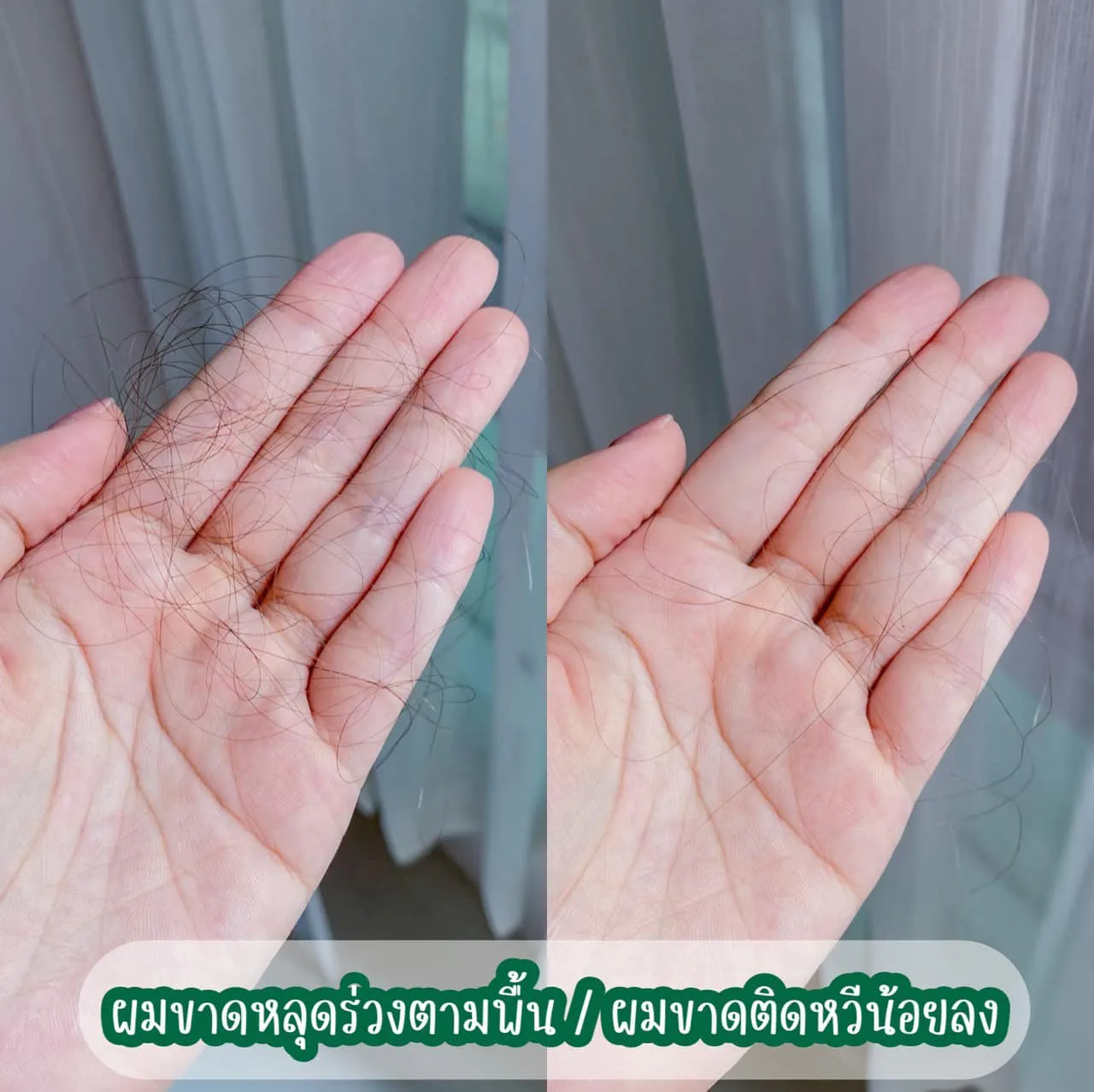 ตอนนี้หันมาใช้แชมพูที่ช่วยลดผมร่วง ผมขาดแบบจริงจัง ของ AloEx