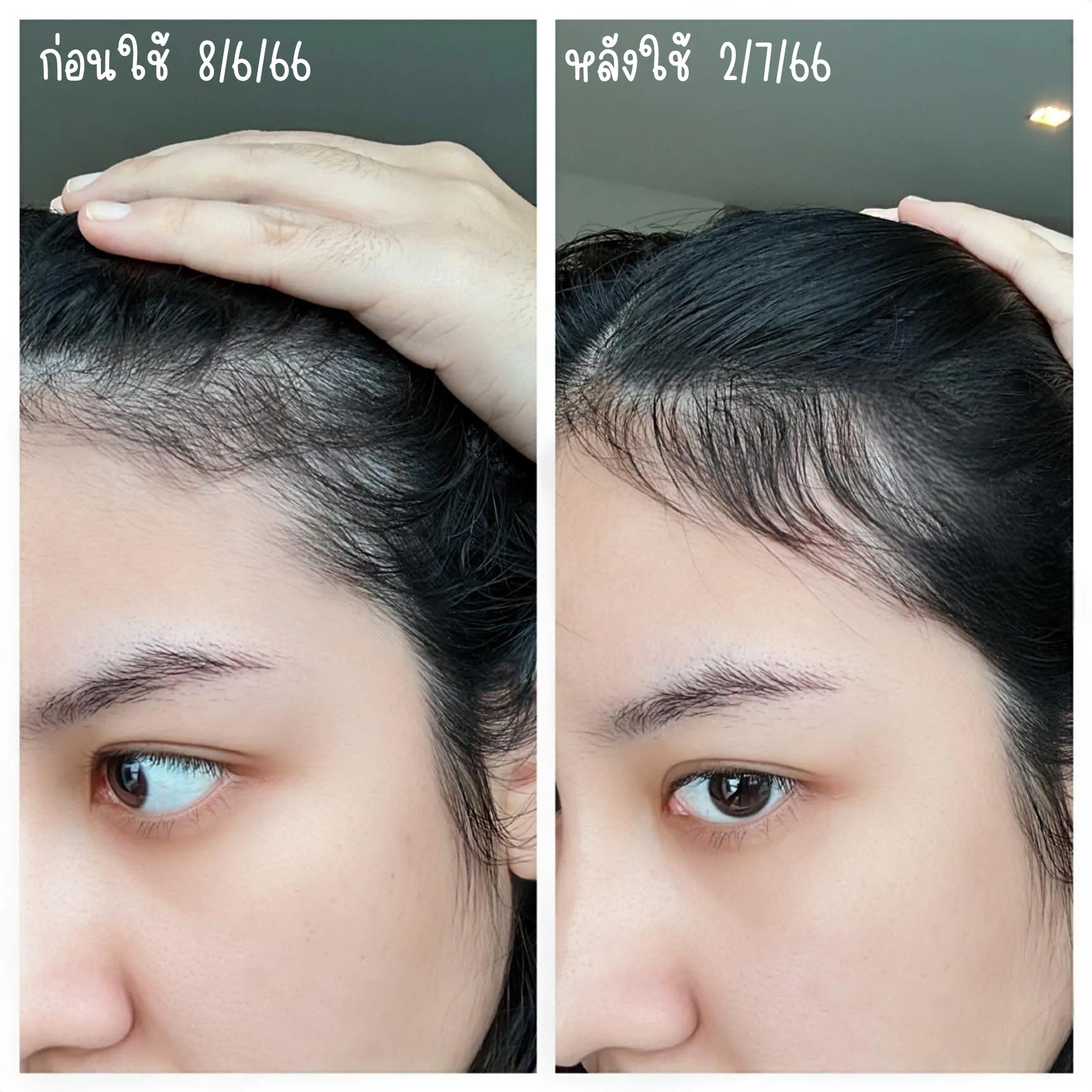 ตั้งแต่มีลูกก็คือร่วงไม่พักเลยจ้าา ตัวล่าสุดที่เราใช้แล้วเห็นผลคือ AloEx Natural Hair Mask