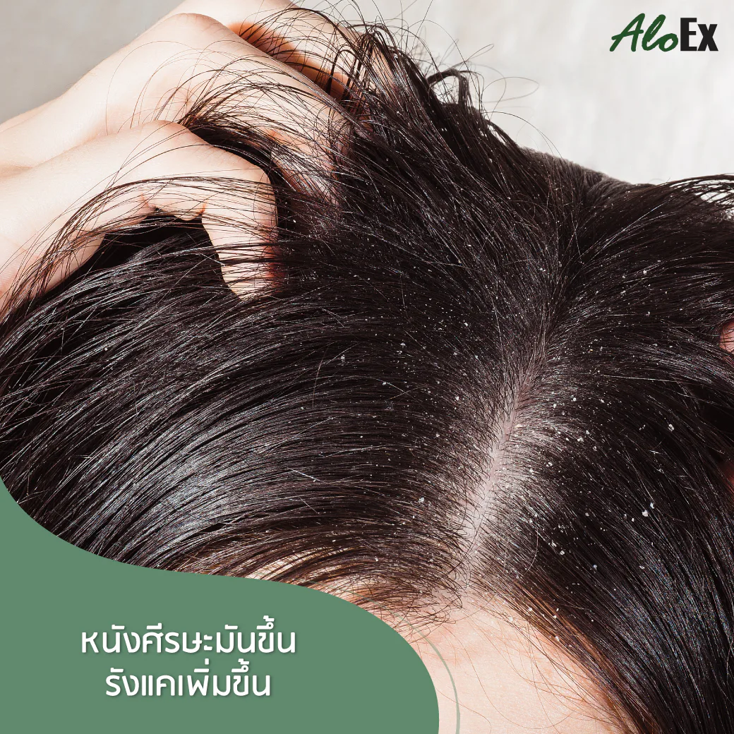 7 ผลลัพธ์ร้ายต่อหนังศีรษะและเส้นผมจากการนอนตอนผมเปียก