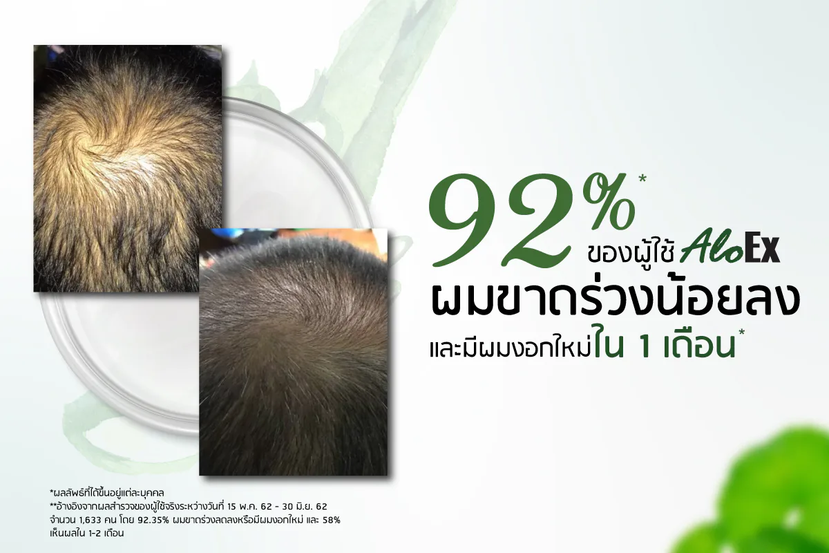 89% ของผู้ใช้ AloEx ผมขาดร่วงน้อยลง และ/หรือ มีผมงอกใหม่