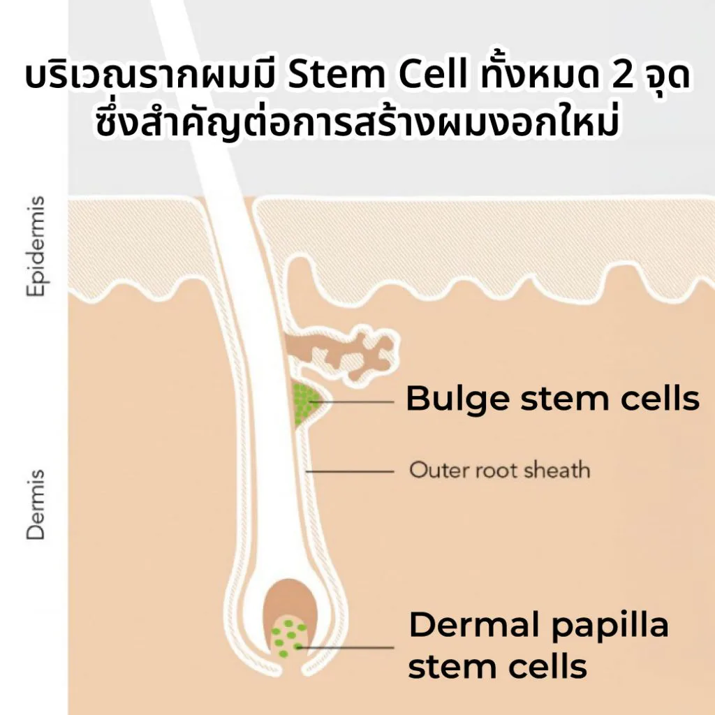 ตำแหน่งของ Stem Cell ในรากผม บริเวณ Bulge Area และ Derma Papilla