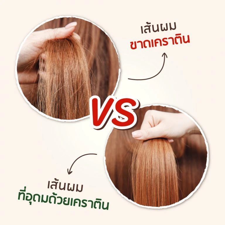 ภาพตัดขวางแสดงชั้นโครงสร้างภายในเส้นผม
