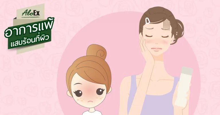อาการแสบร้อนผิวหนังเมื่อสัมผัสสารเคมีรุนแรง