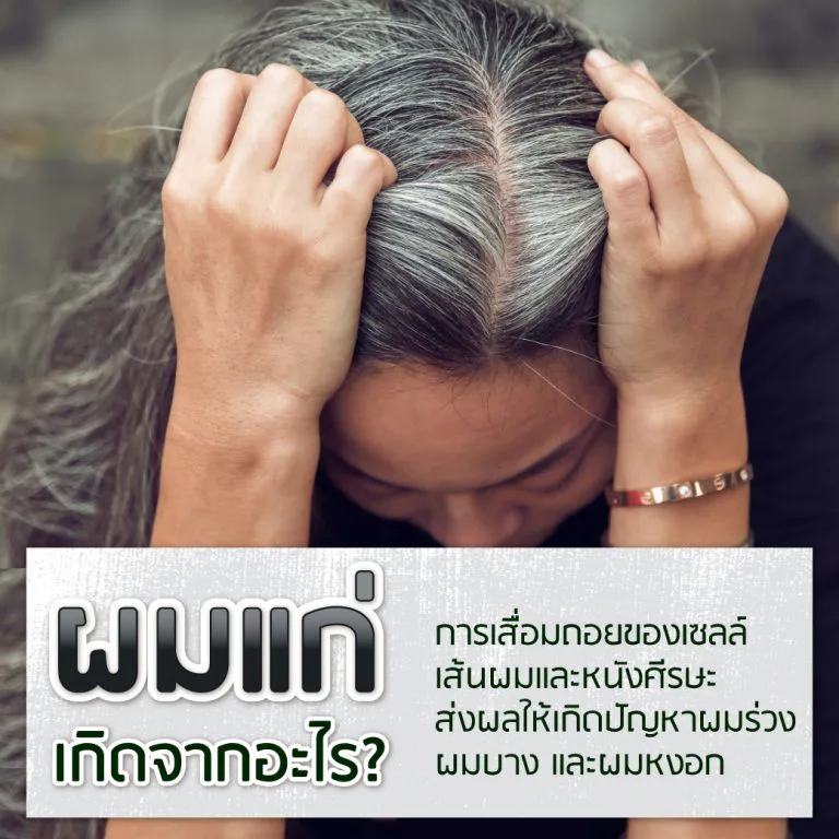ผมหงอกผมขาวที่เกิดจากเม็ดสีเมลานินลดลงตามอายุ