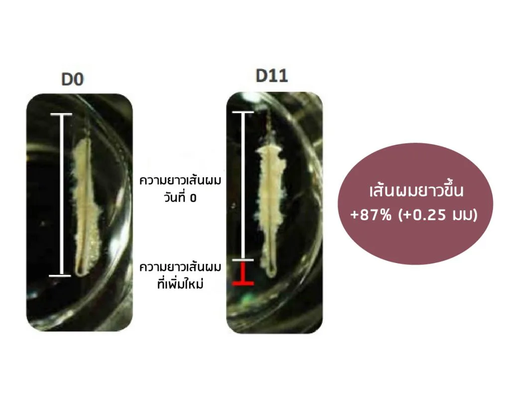 ผลทดสอบ Acetyl Tetrapeptide-3 ใน Capixyl ต่อเซลล์ต้นกำเนิดรากผม
