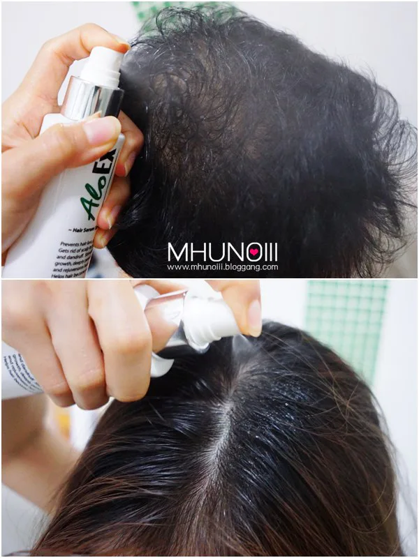 ส่วนผสมสมุนไพรของเซรั่ม AloEx สกัดจากพืชธรรมชาติอ่อนโยน