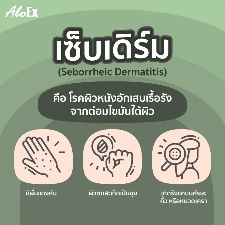 อาการเซ็บเดิร์มที่หนังศีรษะทำให้คันและเป็นรังแค