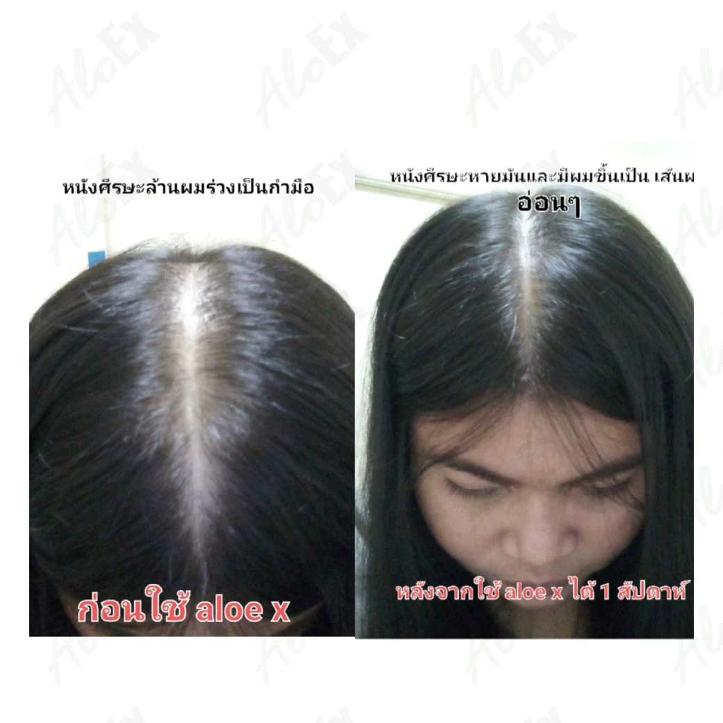 ก่อนใช้-หลังใช้ ผลิตภัณฑ์ AloEx