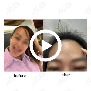 รีวิวก่อนใช้-หลังใช้ ผลิตภัณฑ์ AloEx